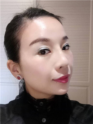 你们来看看我的面部埋埋蛋白线.提升术恢复情况