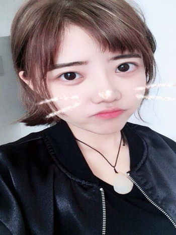 我的隆鼻整形恢复果图  塌鼻子逆袭记