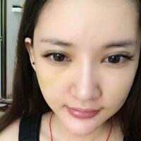 面部面b提升恢复日记和恢复图片，一周左右恢复自然