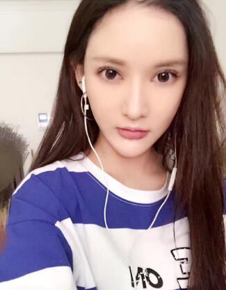 面部面b提升恢复日记和恢复图片，一周左右恢复自然