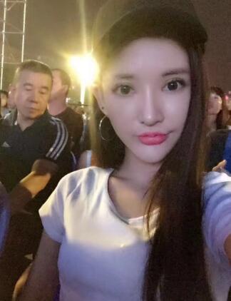 面部面b提升恢复日记和恢复图片，一周左右恢复自然