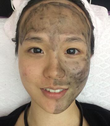 我的黑脸娃娃案例分享