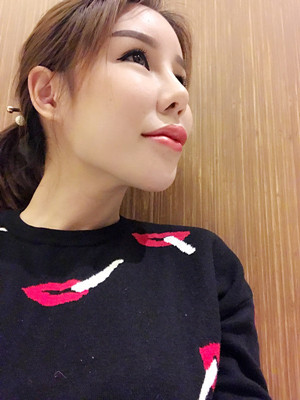 高强度聚焦超声手术三个月的前后恢复记录——海口红妆李科做的