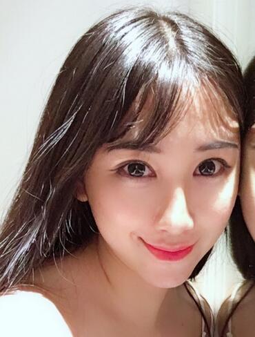 做完光子嫩肤恢复图片 果满满