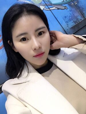 自体脂肪填充全脸经历，脸型超**的