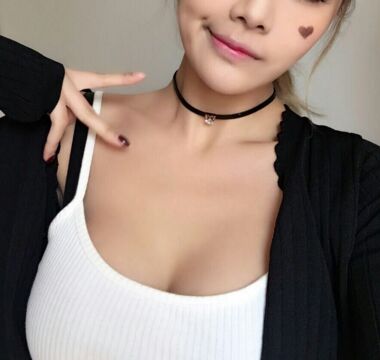 曼托水滴形假体隆胸术后对比照片，身材超火辣