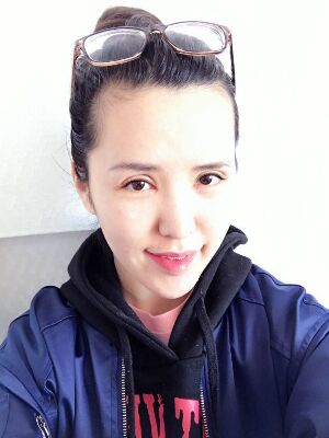 全切双眼皮修复恢复后图片，宽度较为合适哟