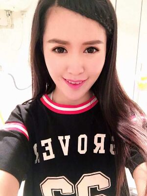 全切双眼皮修复恢复后图片，宽度较为合适哟