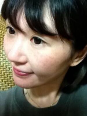 激光去雀斑果好不好，真实案例告诉你