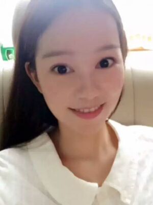 点阵激光祛痘后果对比图，皮肤光滑多了