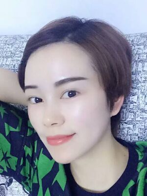 点阵激光祛痘后果对比图，皮肤光滑多了