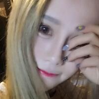 玻尿酸填充卧蚕果对比图，很满意