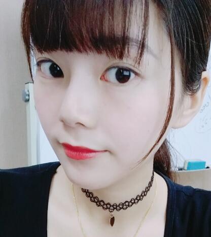 做完光子嫩肤恢复图片和过程分享，光子嫩肤价格3800元