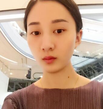 有谁做过激光祛雀斑？个人激光祛雀斑后恢复日记分享