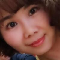 玻尿酸去法令纹后人变年轻了好几岁