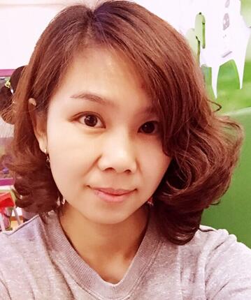 玻尿酸去法令纹后人变年轻了好几岁