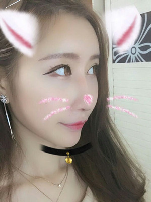 自体脂肪填充面部前后对比果图分享，海南瑞韩徐春梅做的