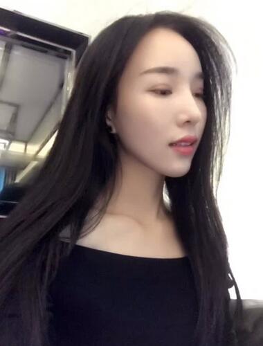 鼻修复后的恢复期经历分享