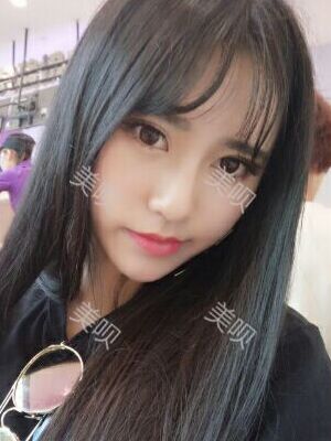 线D隆鼻恢复过程图片，真实案例照片