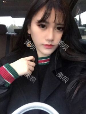 线D隆鼻恢复过程图片，真实案例照片