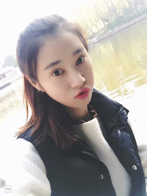 海南瑞韩刘申松给我做的双眼皮+开外眼角手术，前后2个月的恢复记录