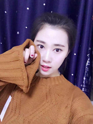 海南瑞韩刘申松给我做的双眼皮+开外眼角手术，前后2个月的恢复记录