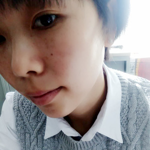 激光祛晒斑真实案例分享，并附上前后对比图片