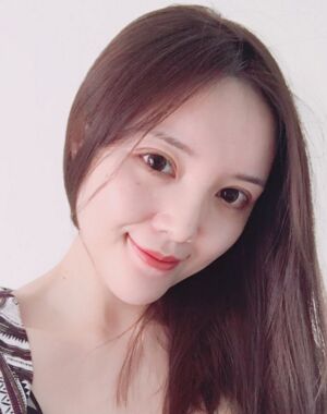 全切双眼皮+硅胶垫下巴真实案例对比图