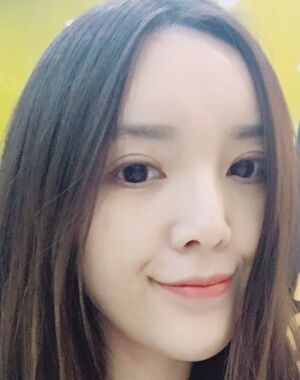 全切双眼皮+硅胶垫下巴真实案例对比图