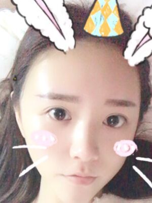 自体脂肪详细部填充日记，恢复过程分享