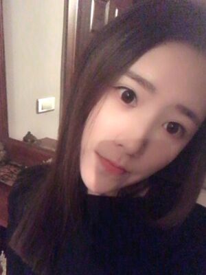 自体脂肪详细部填充日记，恢复过程分享