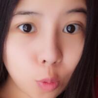 鼻部综合整形恢复过程图分享