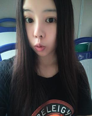 鼻部综合整形恢复过程图分享