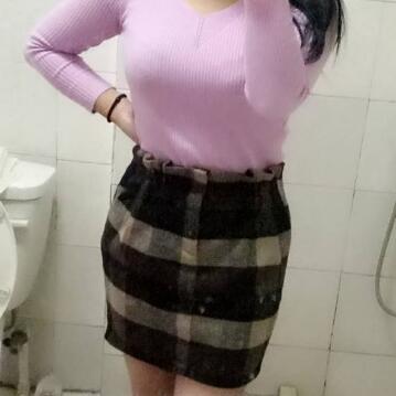 吸脂减肥瘦腰腹不反弹，恢复过程图分享