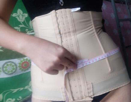 吸脂减肥瘦腰腹不反弹，恢复过程图分享