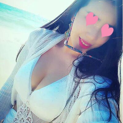 自体脂肪丰胸对比照片，福州爱美尔张胜利做的