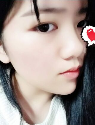 福州爱美尔黄振银面部吸脂亲身经历有图