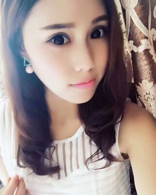 双眼皮失败修复果图，福州爱美尔王召克做的