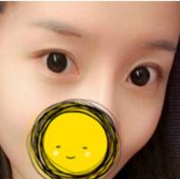 注射瘦脸去抬头纹果不错——济南吉芙美容整形医院