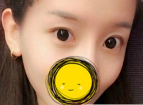 注射瘦脸去抬头纹果不错——济南吉芙美容整形医院