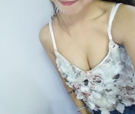 厦门银河整形自体脂肪隆胸术后果对比图