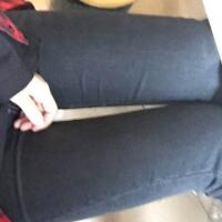 吸脂塑身医院推荐欧兰仁美医院，吸脂瘦腿恢复图分享