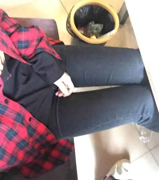 吸脂塑身医院推荐欧兰仁美医院，吸脂瘦腿恢复图分享