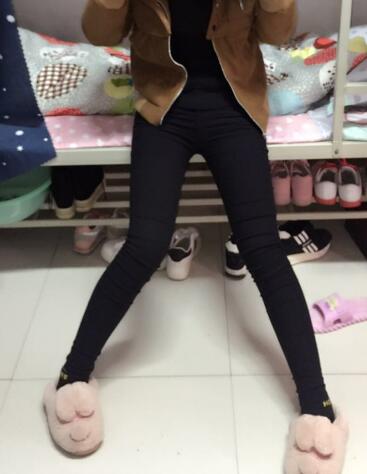 吸脂塑身医院推荐欧兰仁美医院，吸脂瘦腿恢复图分享