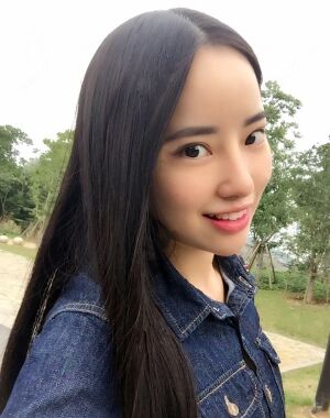 贵阳美莱梁洁隆鼻整形两个月果图