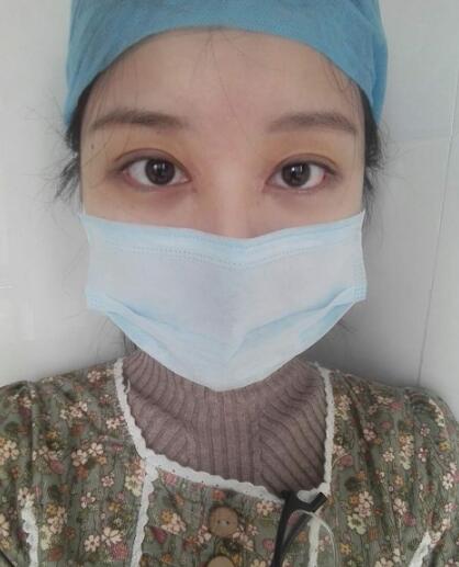 见证全切双眼皮使单眼皮变双眼皮的奇迹~恢复过程图分享