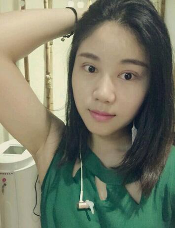 广州妍雅割双眼皮后恢复过程图