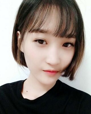 微创全切双眼皮果对比照片，贵阳丽都葛志鑫手术案例