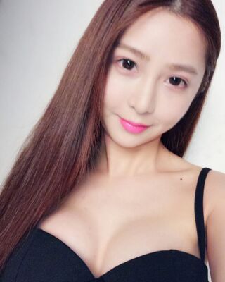 美国曼托假体隆胸手术果图，贵阳丽都李观龙做的