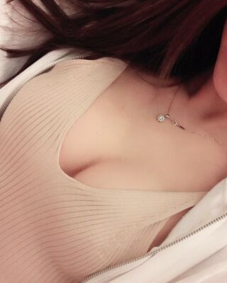 美国曼托假体隆胸手术果图，贵阳丽都李观龙做的